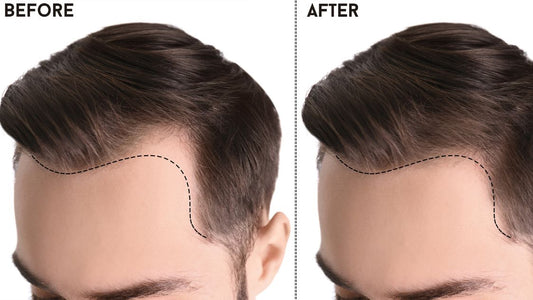 THE HAIR GROWTH CYCLE: A JOURNEY FROM ROOT TO TIP