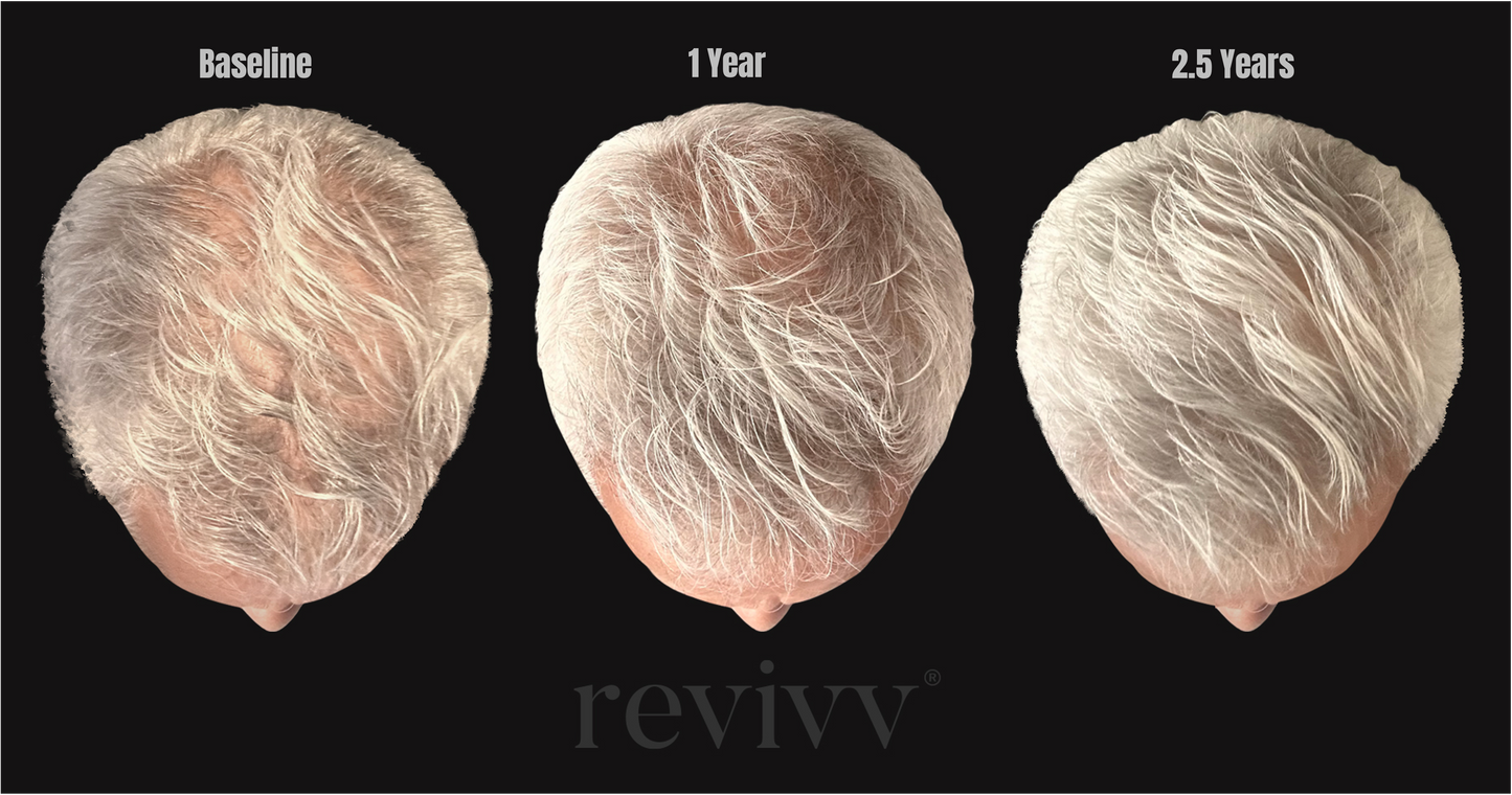Revivv For Him Hair Growth Serum