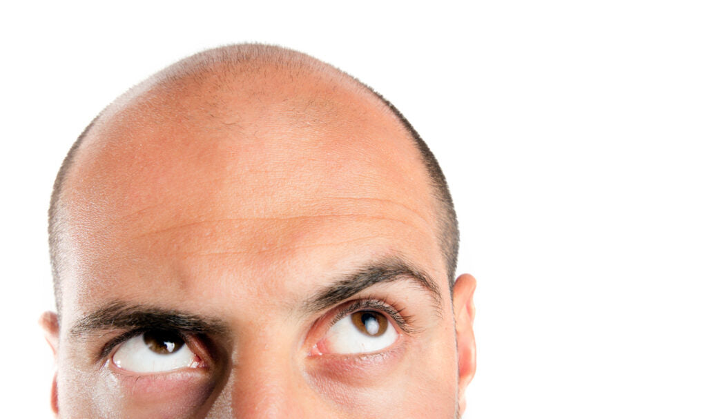 UNDERSTANDING HAIR LOSS: TYPES AND COMMON CAUSES