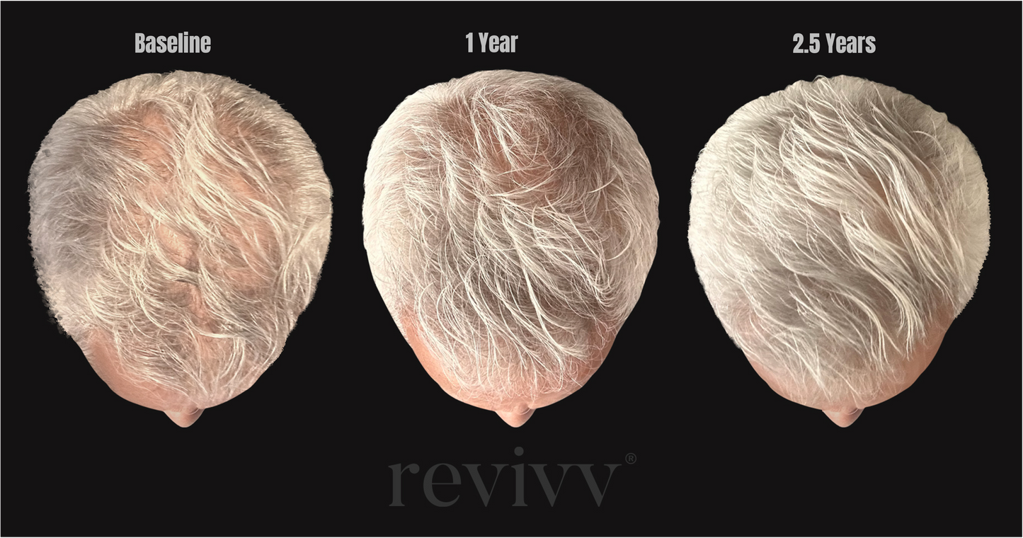 Revivv For Him 3 Month Hair Rejuvenation Serum