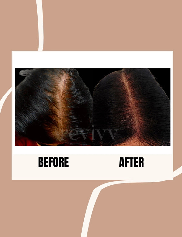 Revivv for her before and after