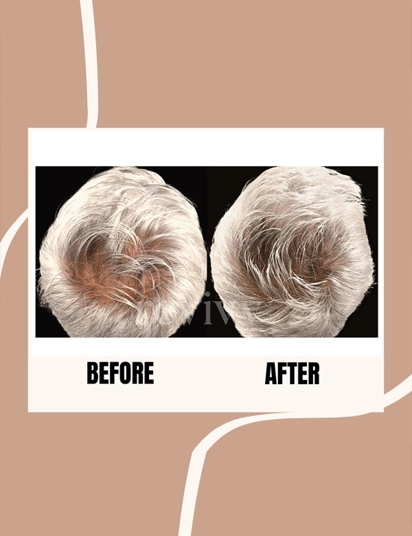Hair Growth Serum Before and After