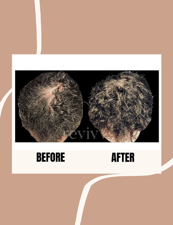 Revivv For Him Before and Aafter
